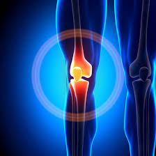 Knee Pain Treatment | Knee Surgeon Florida OrthoCare Surgeon