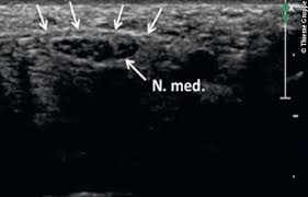 Unable to cope with a recent personal tragedy, la's top celebrity shrink turns into a pothead with no concern for his appearance and a creeping sense of his inability to help his patients. Sonografie Peripherer Nerven Allgemeine Methodik Und Untersuchungstechnik Neurologie Georg Thieme Verlag