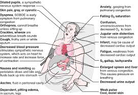 Congestive Heart Failure Cardiac Nursing Heart Failure