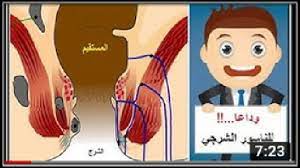 epingle sur طب واعشاب وأغذية