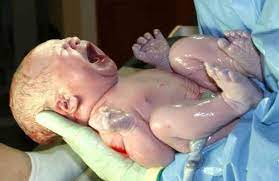 Tentunya cukup saat berikutnya ia datang dengan gemetar. Kuman Gbs Semasa Hamil Boleh Menyebabkan Risiko Bayi Maut Ibu Hamil Kena Hati Hati Pa Ma