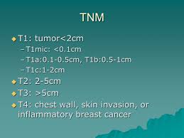 Less common types include inflammatory breast cancer, paget's disease of the nipple, medullary carcinoma, mucinous carcinoma and papillary carcinoma. Breast Cancer Ppt Download