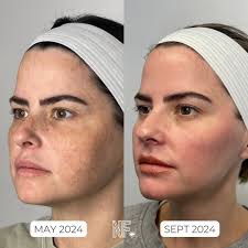 This was my first week back in my happy place, doing what I love, after  being out for 5 weeks. And it was a good one 🤍 Many know, I have been