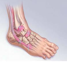 And neurologic and muscle studies such as electromyography. Not Just A Sprain 4 Foot And Ankle Injuries You May Be Missing Mdedge Family Medicine