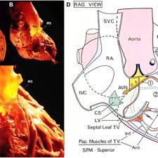 Relationship Of The Membranous Interventricular Septum To Surrounding Download Scientific Diagram
