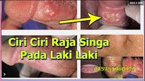 Para ilmuwan menemukan mumi kucing terjepit di siberia timur pada 2017, sebagai anak kucing lynx atau anak singa gua. Ciri Ciri Penyakit Raja Singa Pada Laki Laki Youtube