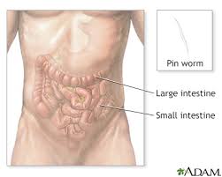 Image result for Pinworm