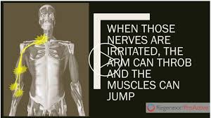 A feeling of being irritated, impatient or slightly angry. Why Is My Arm Throbbing