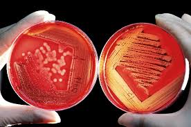 Image result for Fagaropsis