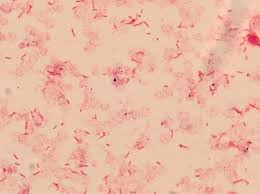 The staining procedure differentiates organisms of the domain bacteria according to cell wall structure. Microbiology Case Study 37 Year Old Male With Cyclic Fever And Severe Headache Lablogatory