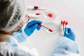 Rle production 33.782 views5 years ago. Batalkah Puasa Orang Yang Menjalani Rapid Test Dan Swab Alias Pcr