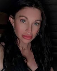 Plastic Surgeon Charged Over Death of Wife Who Suffered a Cardiac Arrest  During Cosmetic Procedures