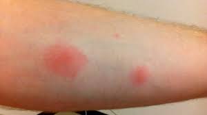 We did not find results for: Apakah Kecoa Menggigit Rentokil Indonesia