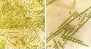 Image result for Cylindropsis