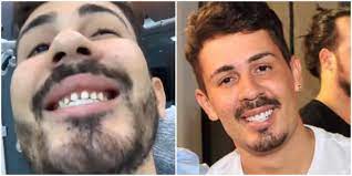 We did not find results for: Video Humorista Carlinhos Maia Mostra Os Dentes Sem A Lente De Contato E Imagem Assusta