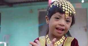 12.2 Million Yemeni Children in Need for Help