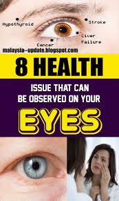 8 Health Issues That Can Be Observed On Your Eyes Health Remedies Health Natural Cough Remedies Natural Cold Remedies