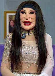 She was a famous actress who appeared in around 100 movies, but one tragic  mistake completely ruined her appearance. Many people are shocked to see  how she looked like before, and you