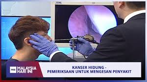 Kanser serviks atau kanser pangkal rahim ini terjadi apabila sel tumbuh secara tidak normal. Kanser Hidung Pemeriksaan Untuk Mengesan Penyakit Mhi 15 Ogos 2019 Youtube
