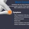 «primary bone osteosarcoma in the pediatric age: Https Encrypted Tbn0 Gstatic Com Images Q Tbn And9gcrdgfsyekw Eggqft2bv46jbtagrzbmvpyatgsz9q3mhx3rit 1 Usqp Cau