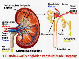 These sentences come from external sources and may not be accurate. Penawar Mujarab Jus Herbaneka Plus Rawat Sakit Buah Pinggang