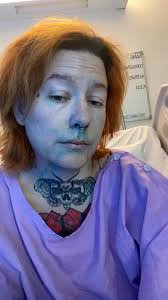 Aloma's Nose Surgery Controversy