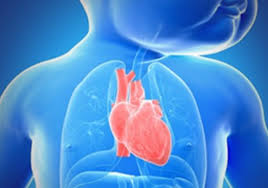 O aneurisma aparece sempre que há a dilatação permanente e exagerada de uma artéria. Cardiopatias Congenitas Sp Cirurgiao Cardiaco Sp