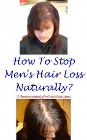 Pin On Hair Loss Stinks