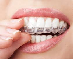 Brushing teeth with braces isn't too different than brushing without braces. Top Ten Tips For How To Remove Invisalign Braces My Invisalign Blog