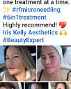 Iris Kelly (@iriskellyaesthetics) • Instagram photos and videos