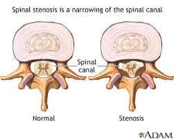 This article looks at the anatomy of the back, including bones, muscles. Hie Multimedia Low Back Pain Chronic
