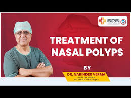 Treatment of Nasal Polyps by Dr. Narinder Verma