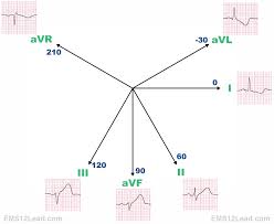 12 Lead Diagram Artery Wiring Diagrams