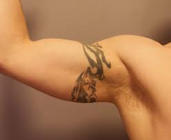 How many sessions will be needed before my tattoo is removed? Laser Tattoo Removal Before And After The Untattoo Parlor Pain Free Tattoo Removal