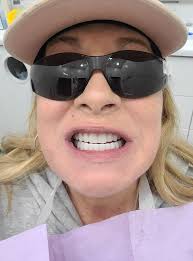 Bionic Smile Dental Surgery Experience