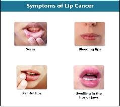 In the later stages, weight loss could mean that the tumor has spread to other areas such as the liver. Sanjeevani Cbcc Usa Cancer Hospital Raipur