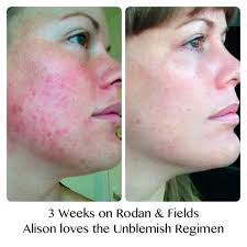 Beautiful Skin by Britt