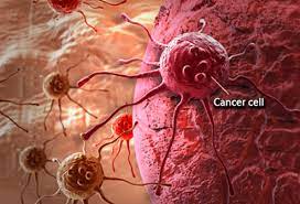 18 Common Cancer Symptoms And Signs In Men And Women