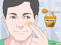 Maybe you would like to learn more about one of these? 3 Cara Untuk Menghentikan Whitehead Komedo Putih Wikihow