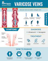 Varicose Veins Causes Treatment Diagnosis And Prevention Apollo Spectra