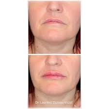 Dr Laurent Dumas Vidal (@dr_laurent_dumas_vidal) · Instagram photos and  videos