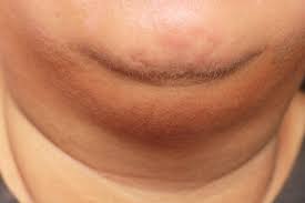 Kata yang dicetak tebal digunakan dalam tingkatan bahasa jawa halus krama. Cara Menghilangkan Double Chin Untuk Pria Dan Wanita Honestdocs