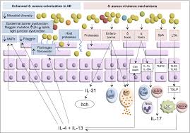 It added that the temporary suspension of astrazeneca's vaccine would delay norway's vaccine rollout, and said that people who had received their first dose. The Role Of Bacterial Skin Infections In Atopic Dermatitis Expert Statement And Review From The International Eczema Council Skin Infection Group Alexander 2020 British Journal Of Dermatology Wiley Online Library