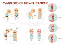 Out of all cases of colorectal cancer , some 70% of malignancies occur in the colon (the large intestine) and 30% appear in the rectum. Bowel Cancer Stock Vector Illustration Of Growth Digestion 64438235