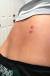 Ringworm Treatment