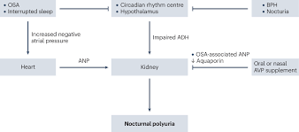 Image result for Polyuria