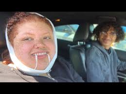 i got my WISDOM TEETH removed and this happened...