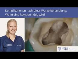 Um eine ausbreitung der entzündung auf den kiefer zu verhindern, wird eine zahnwurzelbehandlung vorgenommen. Entzundung Nach Einer Wurzelbehandlung Revision