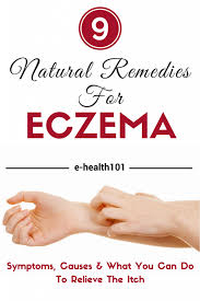 Eczema Symptoms Causes And 9 Natural Remedies To Help Relieve The Itch Eczema Remedies Eczema Symptoms Natural Eczema Remedies