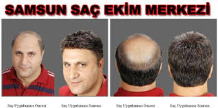 Samsun Da Sac Ekimi Yapan Yerler Samsun Haber Geziler Sac Danca